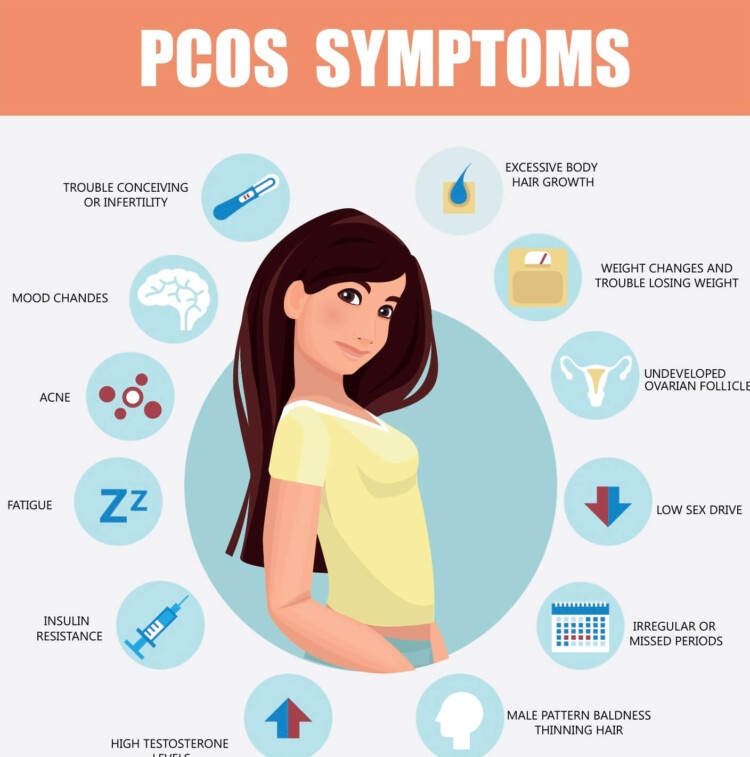 Polikistik Over Sendromu (PCOS): Nedenleri, Belirtileri ve Yaşam Tarzı Önerileri